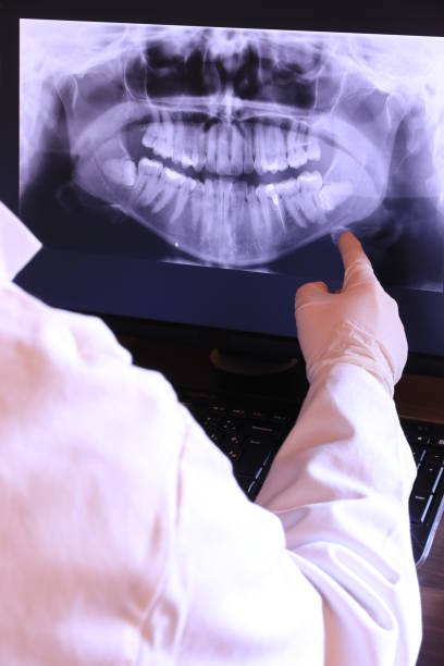 Best Emergency Tooth Extraction in Hanna City, IL