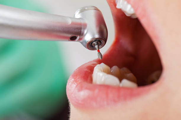 Best Emergency Orthodontic Repairs in Hanna City, IL